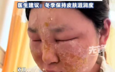 黄金狂飙，300克黄金变现30万：女子巧借金价暴涨实现财富增值